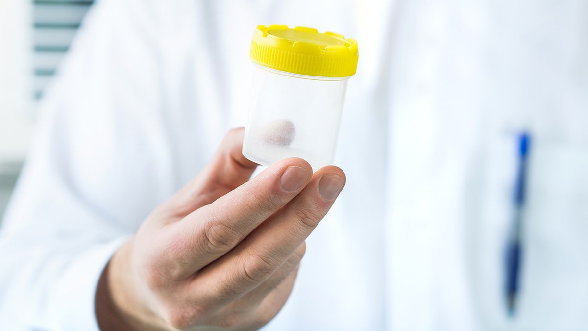 Doctor holding sample cup
