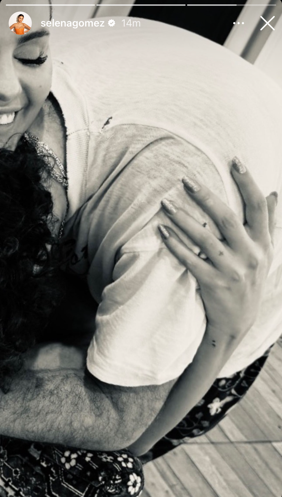 a person with the hands on the face