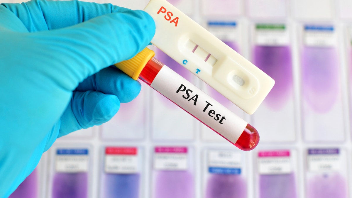 PSA testing (prostate cancer diagnosis) by using test cassette, the result showed positive (double red line)