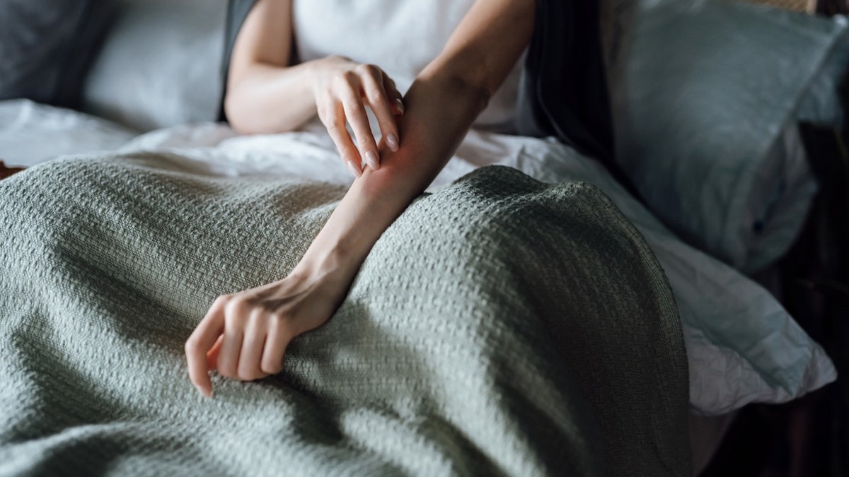 Woman itchy rash