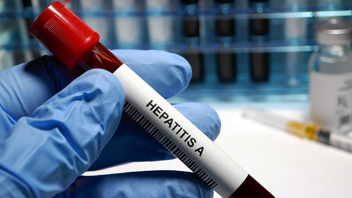 Hepatitis A blood test