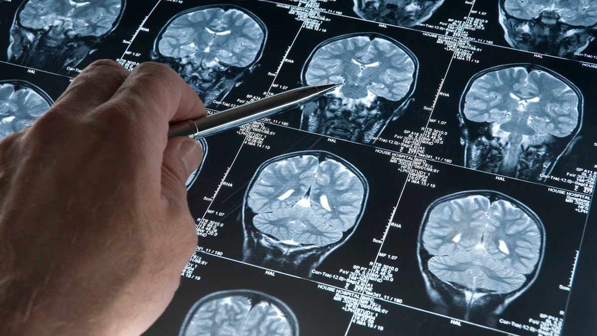 Brain scans