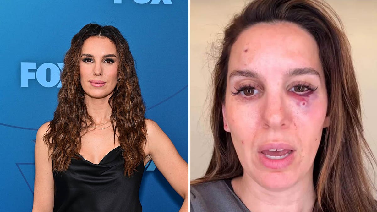 christy carlson romano on a red carpet/christy carlson romano's face after being shot