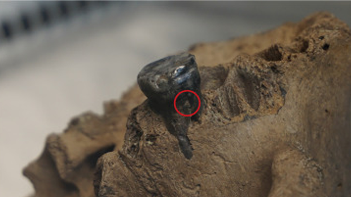 Tooth of the "dragon man" skull