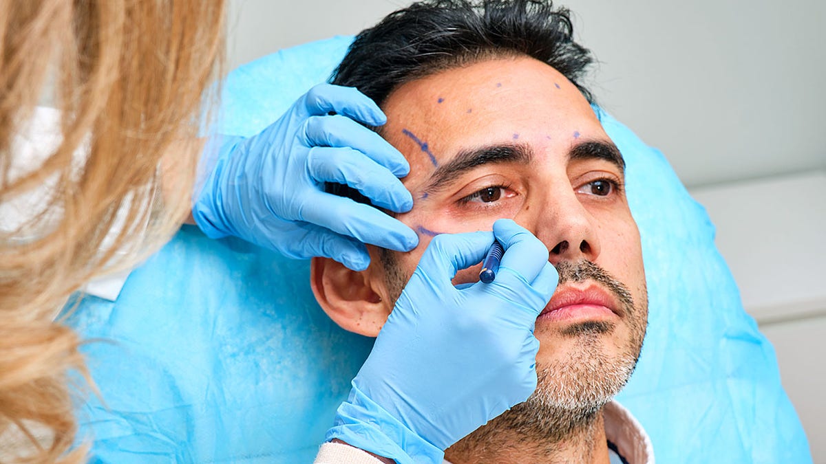 painting the face of a 45-year-old man for an aesthetic treatment with botulinum toxin