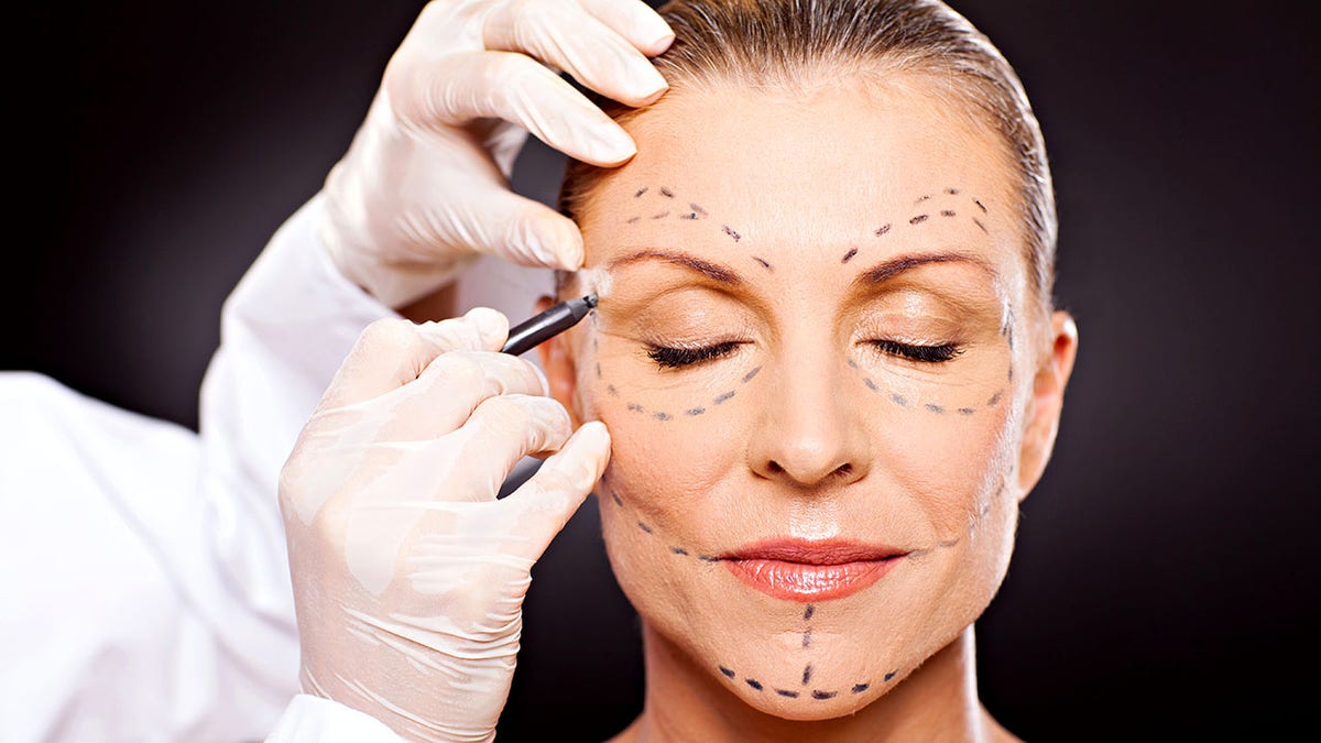 middle aged woman with correction marks preparing for plastic surgery