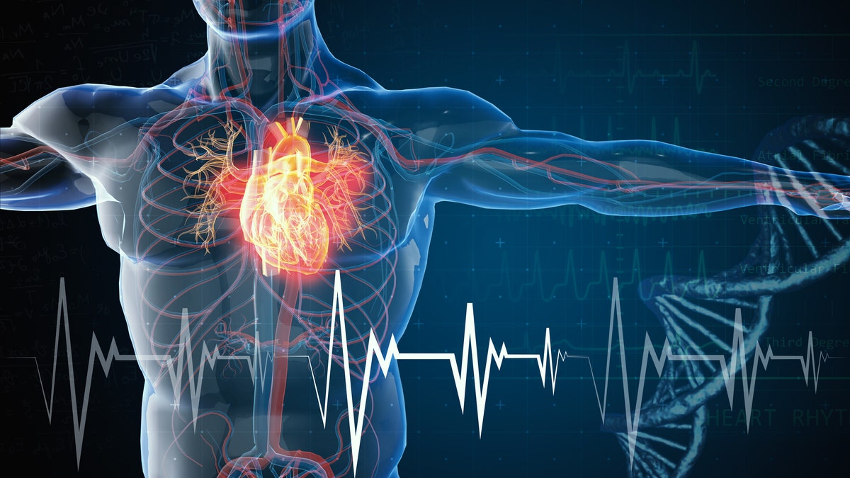 Heart attack graph depiction