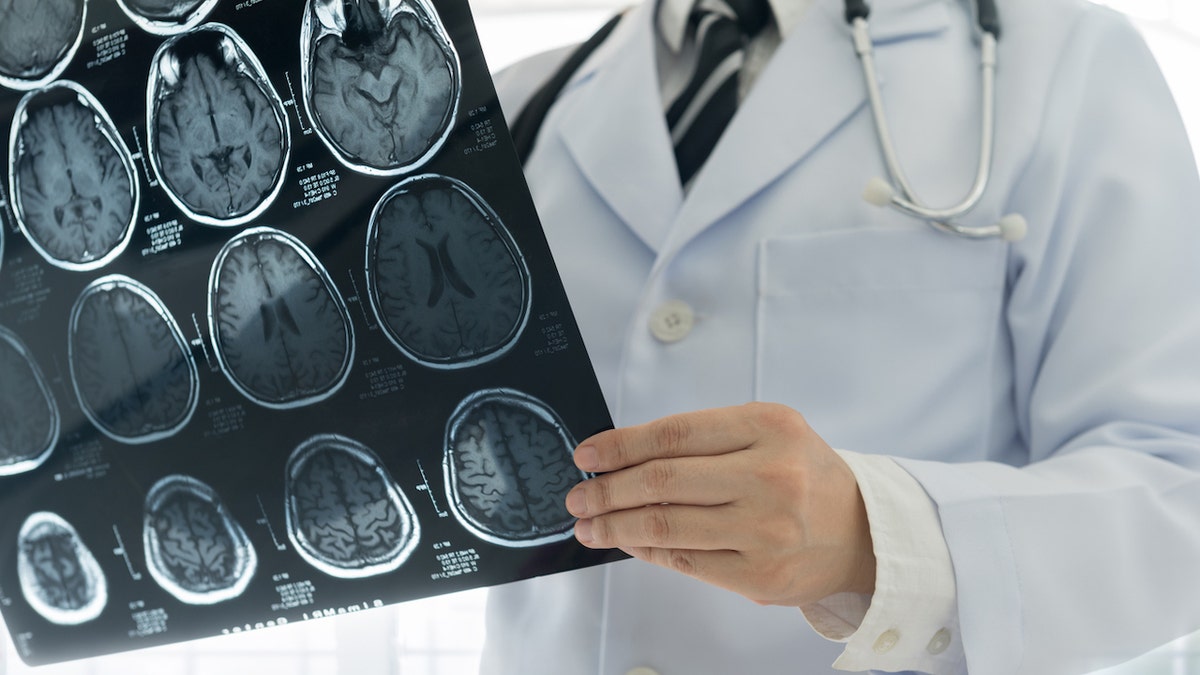 Brain scans