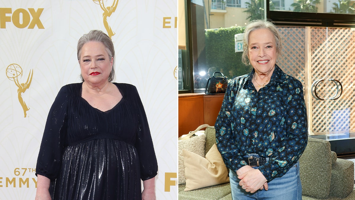 Kathy Bates before and after weight loss