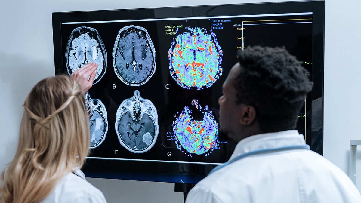 Female and male doctors examine a brain scan